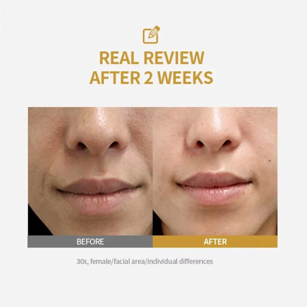 U&I_Deep Collagen.Silk Peptide_Facial.Ampoule4